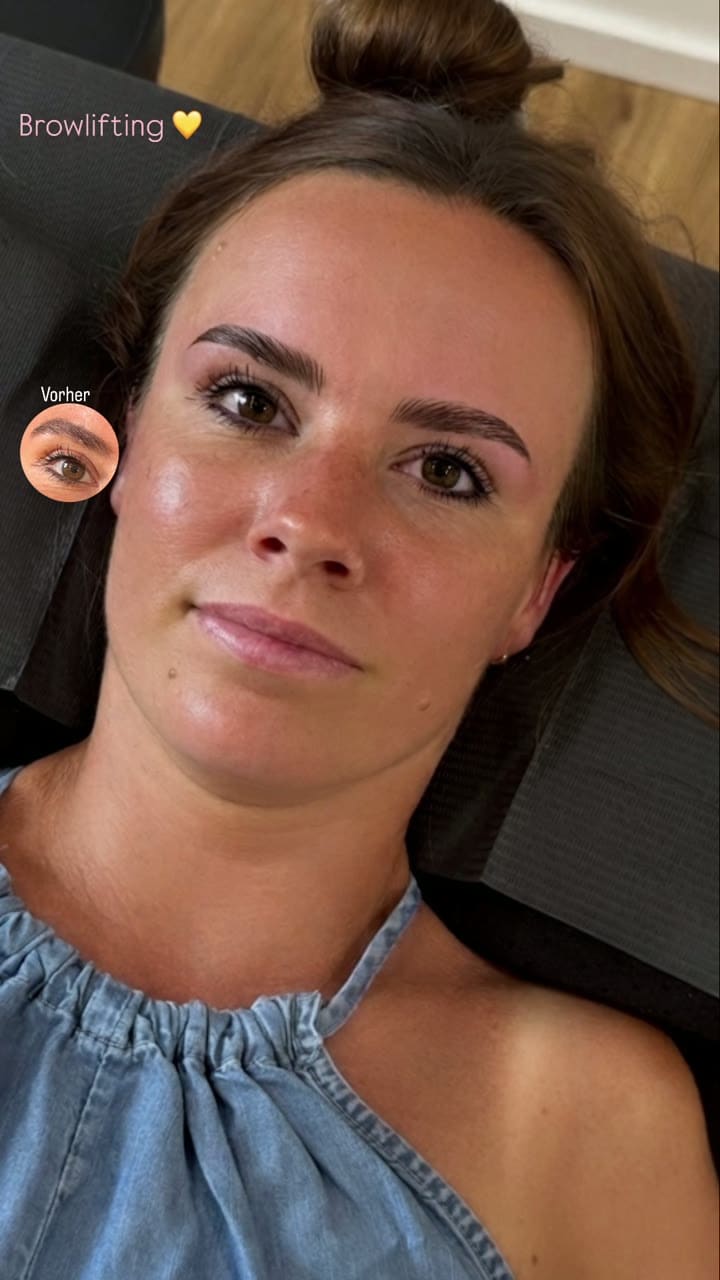 Ergebnis eines Browliftings